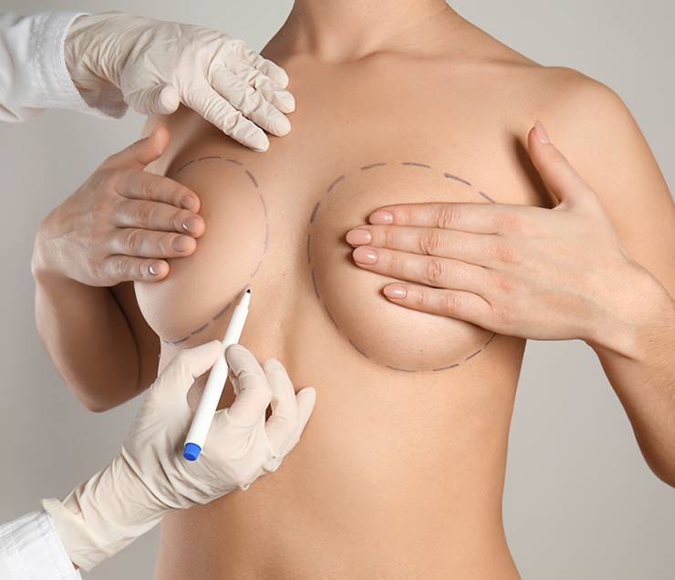 Αυξητική Στήθους