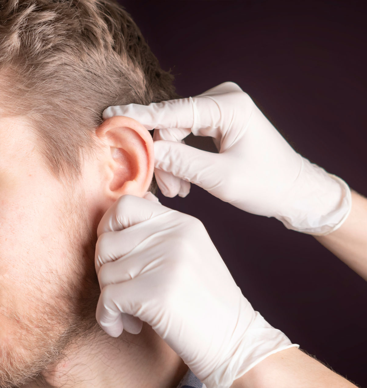 Ωτοπλαστική